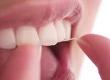 The Risks of Teeth Whitening and Veneers