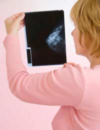 Mammogram; Cancer; Screening; Diagnosis;