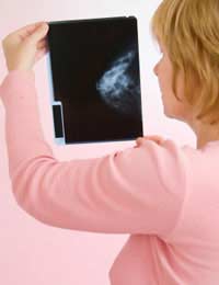 Breast Cancer; Tumours; Benign;