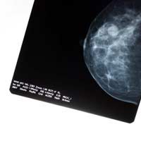 Breast Cancer Survival Treatment