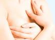 What Are Breast Cysts?