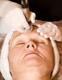 Dermabrasion Skin Blemishes Acne Scars